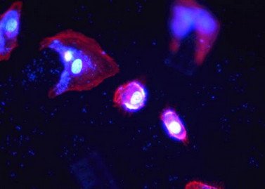 Live Cell