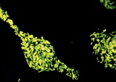 Cell Culture