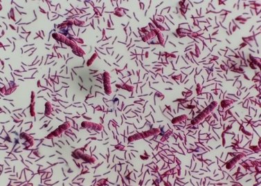 Cell Culture