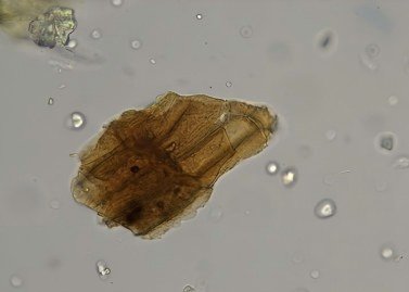 Nematodes